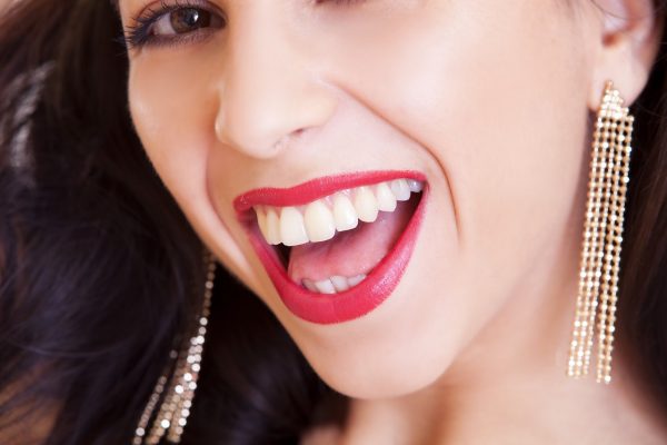 Blog Mason Dentistry - Veneers